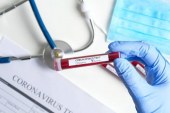 إلغاء شرط فحص PCR من أجل الدخول إلى الأراضي المغربية