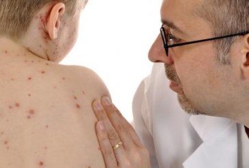 تسجيل انخفاض متواصل في حالات الإصابة بفيروس الحصبة للأسبوع الخامس على التوالي